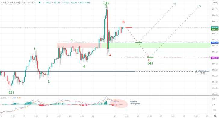 Gold 1H Price Chart